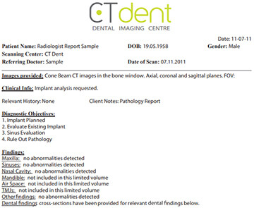 CTDENT Dental Radiology Report