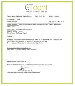 CT Dent 2-262x300 2  
