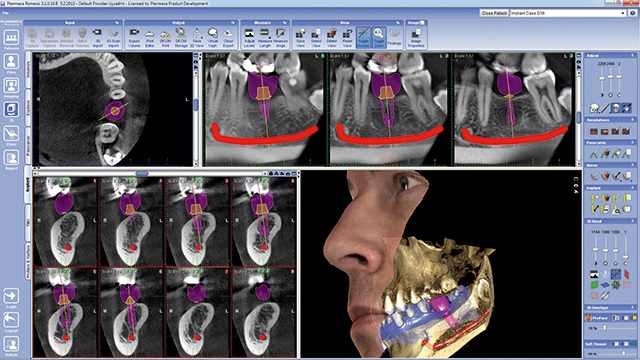 Romexis Viewer - Dental Scanning Services - CT Dent Ltd