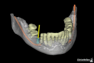 simplant viewer for mac