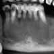 CT Dent Capture-1-new-v2-80x80 CT Dent British Dental Journal Article  