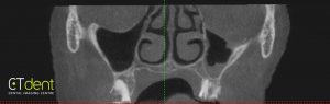 CT Dent Fourth-image-300x95 Fourth image  
