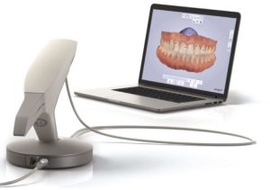CT Dent Intra-Oral-scanner-300x211 Intra Oral scanner  