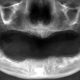 CT Dent Jan19-1-80x80 CT Dent is at Professional Dentistry London this week  