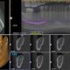 CT Dent CBCT-Implant-image-from-Zahra-80x80 Unlocking Precision in Dentistry: The Vital Role of Dental CT scan Viewing Software  