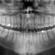 CT Dent OPG-700-80x80 CBCT Level 1 training – ONLINE COURSE 