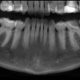 CT Dent Case1-80x80 CT Dent Celebrates CQC 'GOOD' Rating  