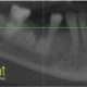 CT Dent COMAug1-80x80 CT Dent Celebrates CQC 'GOOD' Rating  