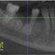 CT Dent COMAug1-80x80 10 years on and still no need to purchase a scanner  