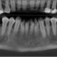 CT Dent COMNov1-80x80 Case of the Month - Implant Planning at Multiple Sites in the Mandible  