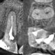 CT Dent COM3Jan2020-80x80 Case of the Month - Implant Planning at Multiple Sites in the Mandible  