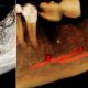 CT Dent COM3Mar2020-80x80 COVID-19 update from CT Dent  