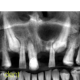 CT Dent 1-1-80x80 AI in Dental Radiology – Are we there yet?  