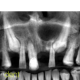 CT Dent 1-1-80x80 Case of the month - Identifying expended lesion  