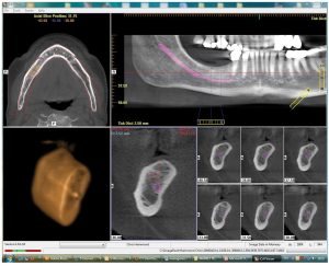 CT Dent icat-300x243 icat  