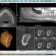 CT Dent icat-80x80 Exploring the Precision of Dental CT scans in Diagnosis and Reporting  