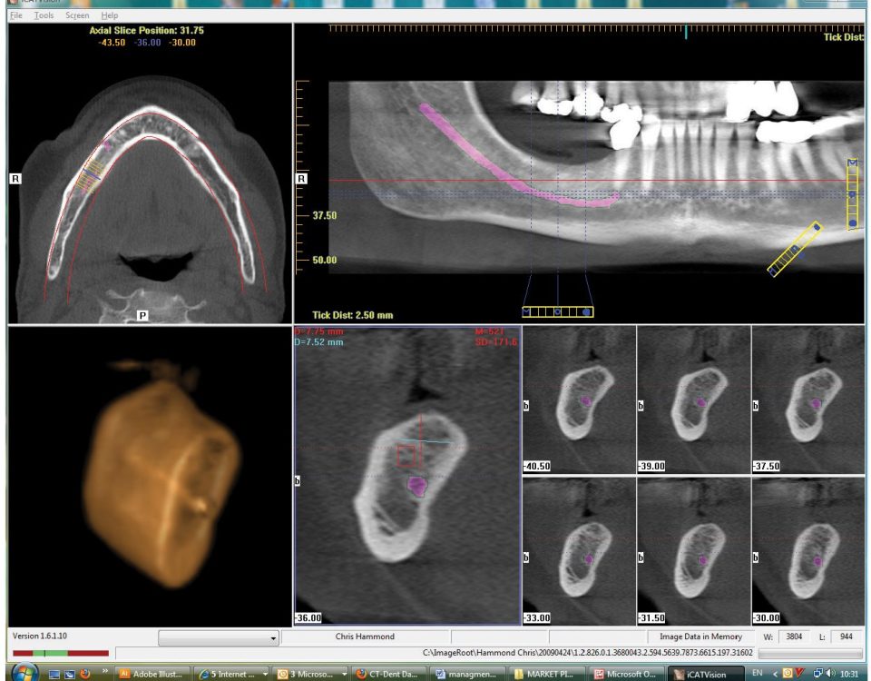 CT Dent icat-960x750 Exploring the Features of ICAT CBCT Software: A Comprehensive Overview  