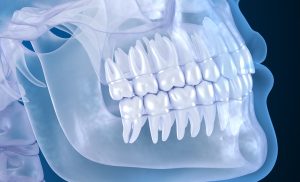 CT Dent The-Importance-Of-Having-A-CBCT-Scan-Before-A-Dental-Implant-300x182 The-Importance-Of-Having-A-CBCT-Scan-Before-A-Dental-Implant  