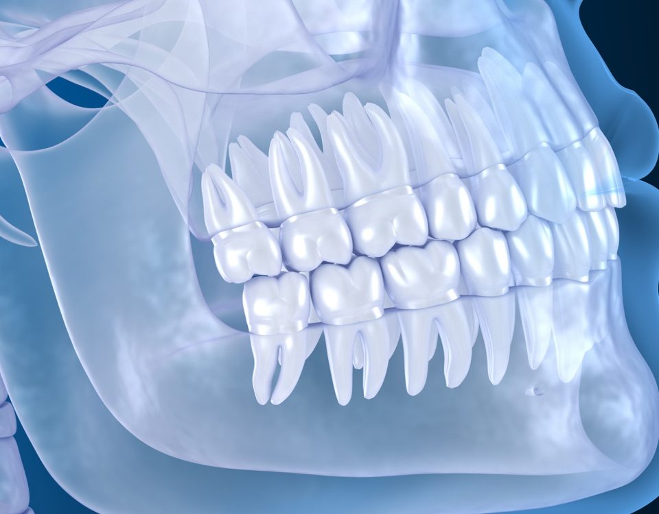 CT Dent The-Importance-Of-Having-A-CBCT-Scan-Before-A-Dental-Implant-960x750 Understanding Normal Anatomy on Dental CBCT Scans  